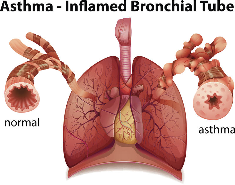 ashtma_lungs